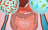 Дисбактериоз кишечника