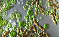 Микробиологическое загрязнение воды