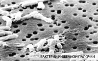 Бактерии кишечной палочки на трековой мембране